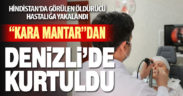 Hindistan’da daha sık görülen ve burunda gelişen “kara mantar hastalığı”ndan başarılı operasyonla kurtuldu