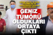İşitme azlığı, burun tıkanıklığı ve yutkunmada zorluk geniz tümörü olabilir