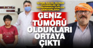 İşitme azlığı, burun tıkanıklığı ve yutkunmada zorluk geniz tümörü olabilir