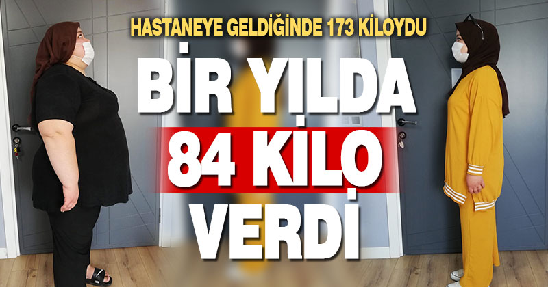 Tüp mide ameliyatıyla 84 kilo veren genç kız, hastalıklardan da kurtuldu