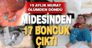 19 aylık Murat’ın midesinden 17 boncuk mıknatıs çıkarıldı
