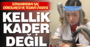 Uzmanından saç dökülmesi ve tedavi uyarısı: Kellik kader değil