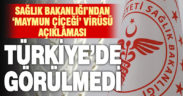 Sağlık Bakanlığı Türkiye’de bugüne kadar ‘maymun çiçeği’ vakası görülmediğini bildirdi