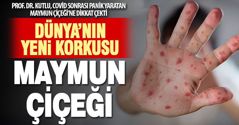 Prof. Dr. Selda Sayın Kutlu, Maymun Çiçeği hastalığına dikkat çekti