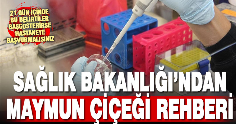 Sağlık Bakanlığı ‘maymun çiçeği’ rehberi hazırladı