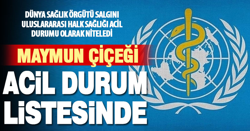 DSÖ, maymun çiçeği salgınını Uluslararası Halk Sağlığı Acil Durumu olarak niteledi