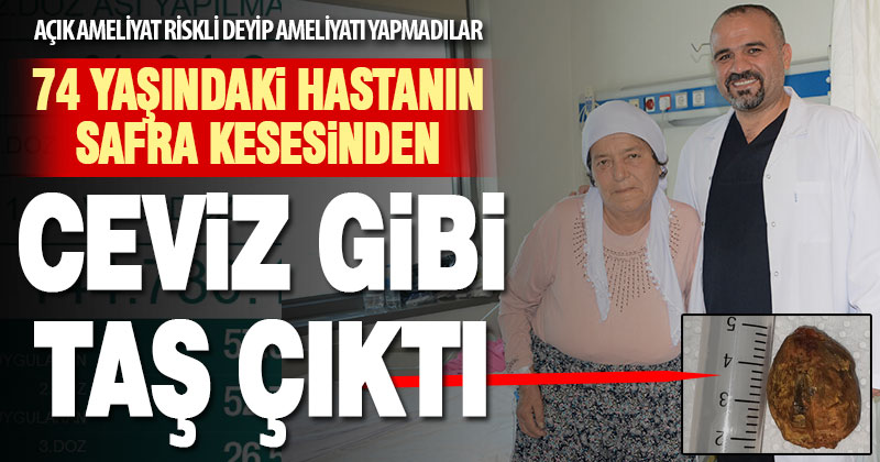 PAÜ’de 74 yaşındaki hastanın safra kesesinden ceviz büyüklüğünde taşı çıkarıldı