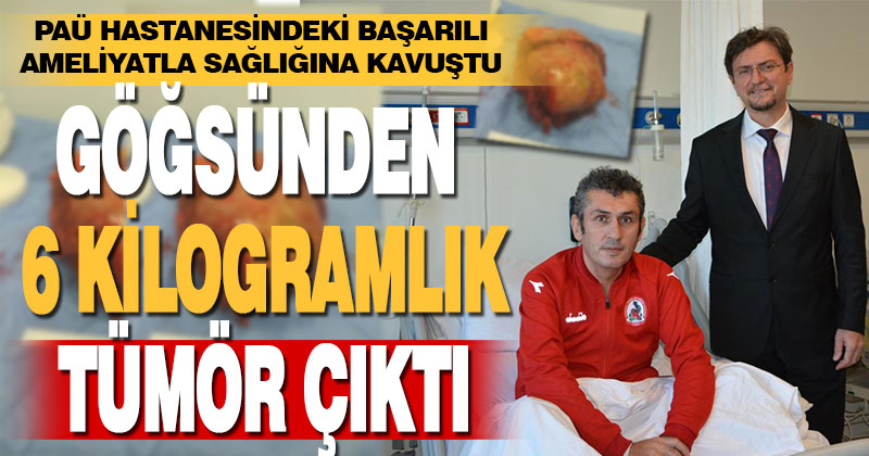Denizli’de bir hastanın göğsünden yaklaşık 6 kilogramlık tümör çıkarıldı