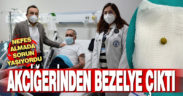 Denizli’de bir hastanın akciğerinden bezelye çıkarıldı
