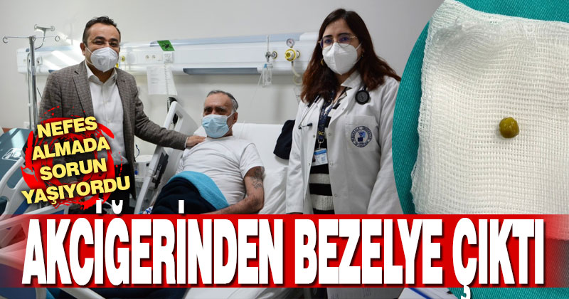 Denizli’de bir hastanın akciğerinden bezelye çıkarıldı
