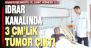 İdrarında kanama ve ağrı olan hastanın idrar kanalında 3 cm’lik tümör çıktı