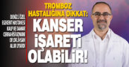 Tromboz hastalığına dikkat: Kanser işareti olabilir!