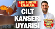 Korumasız ve uzun süre güneşe maruz kalmak cilt kanserini riskini artırıyor