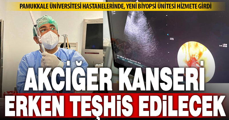 Akciğer kanserini erken teşhis edebilen Kriyobiyopsi Yöntemini PAÜ’de uygulanmaya başladı