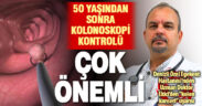 Uzman Doktor Ekici, kolon kanserine karşı kolon polipleri ile ilgili bilgi verdi