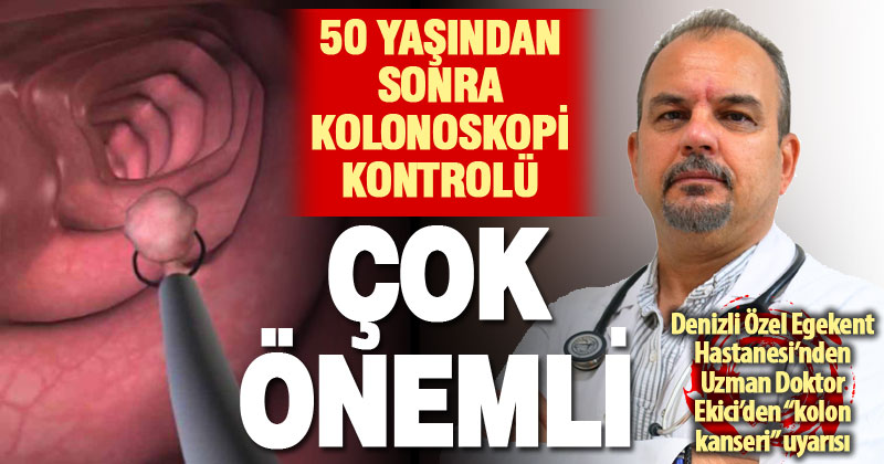 Uzman Doktor Ekici, kolon kanserine karşı kolon polipleri ile ilgili bilgi verdi