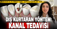 “Kanal tedavisinden korkmanıza gerek yok”
