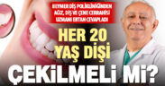 Her 20 yaş dişi çekilmeli mi?