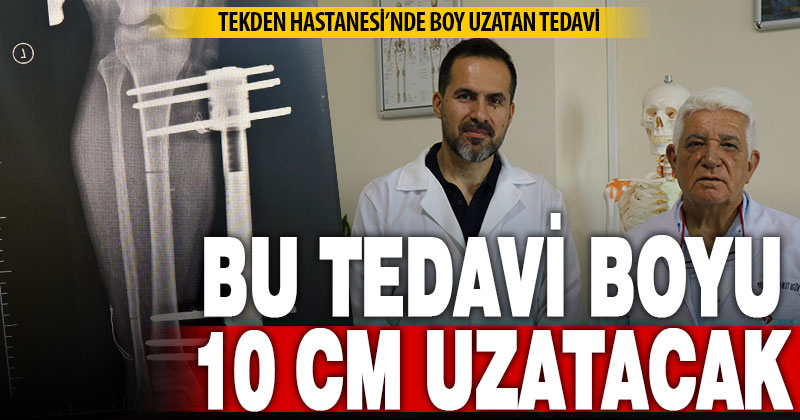 Kısa boy takıntısından Denizli Tekden’de kurtuldu