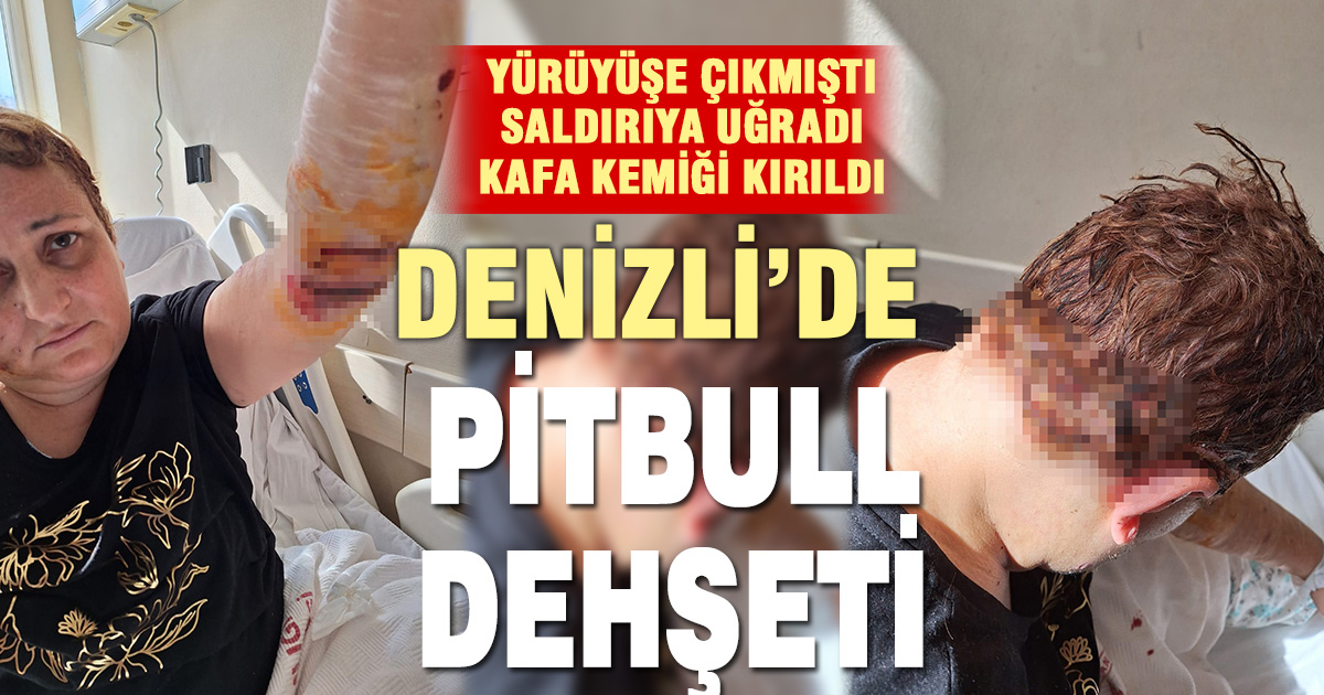 Denizli’de pitbull dehşeti: Kadının kafa kemiği kırıldı
