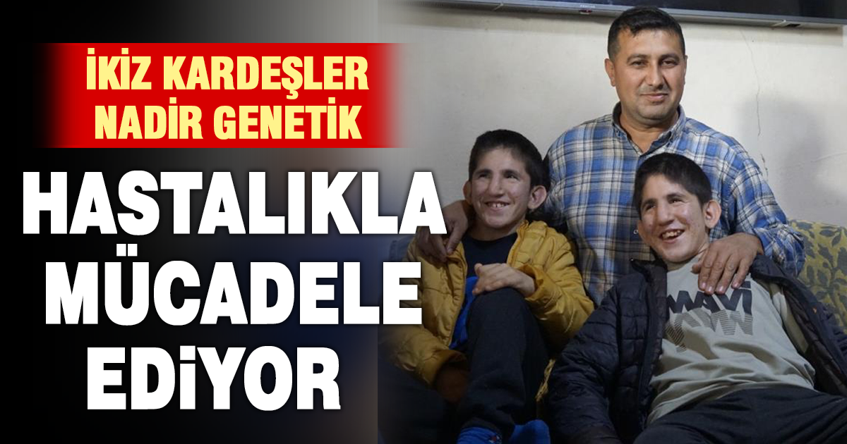 13 yaşındaki ikizler Kromozom 4q Delesyon Sendromu ile mücadele ediyor 