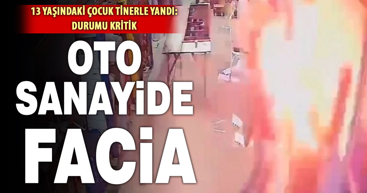 13 yaşındaki çırak tinerle yandı, ağır yaralandı