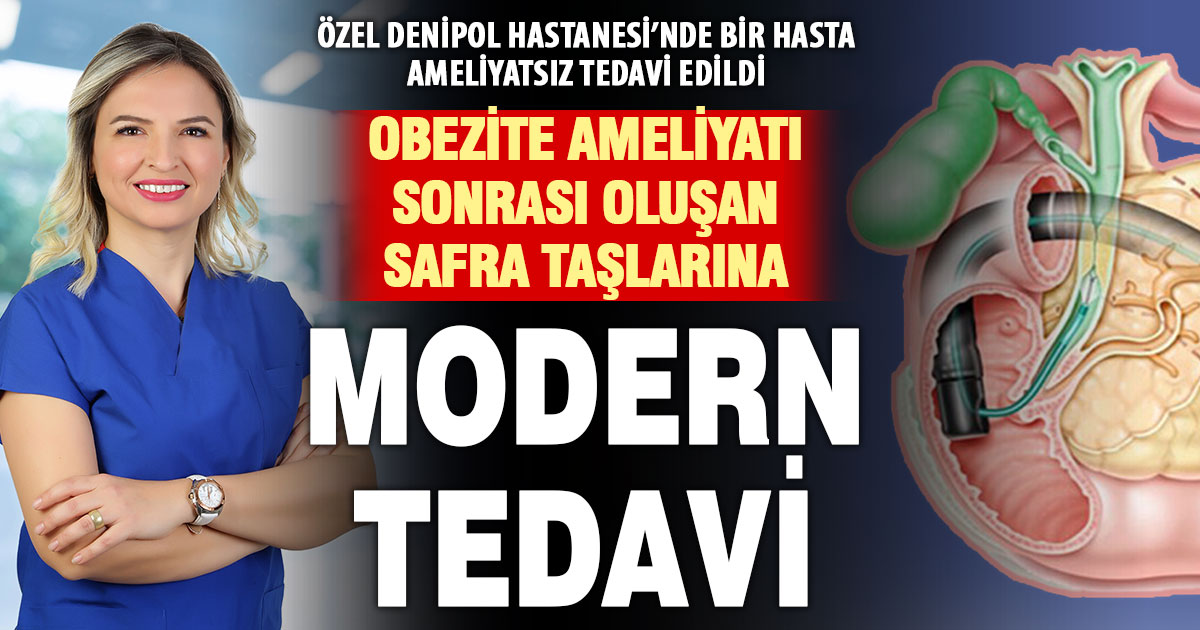 Özel Denipol Hastanesi’nde obezite ameliyatı sonrası oluşan safra kesesi taşlarına başarılı operasyon