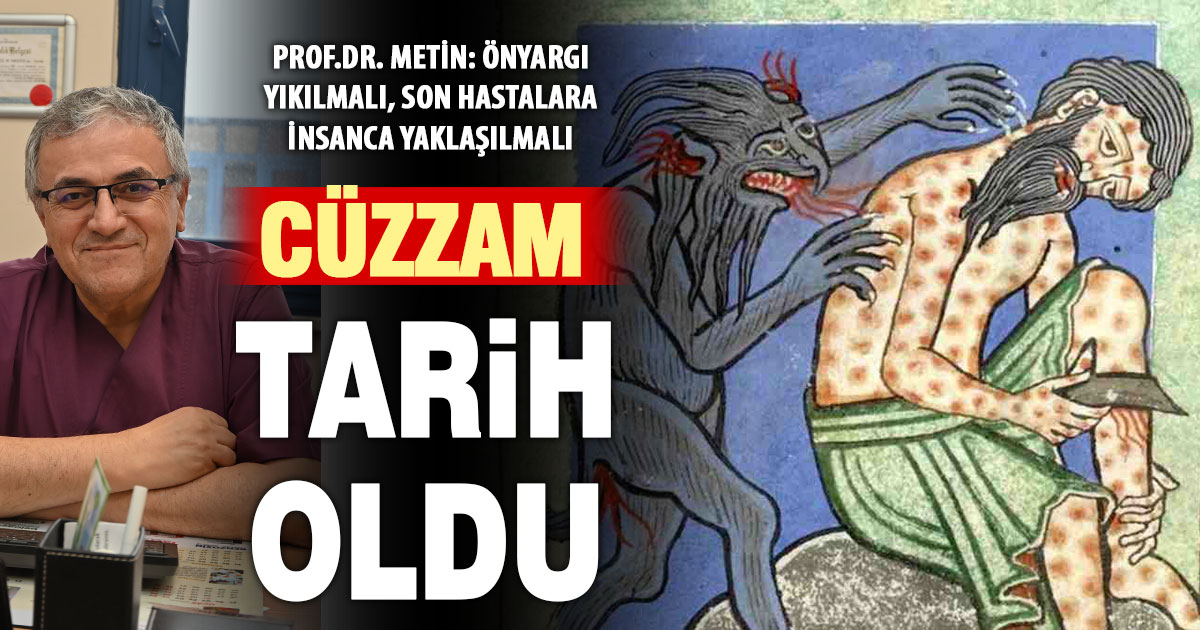Prof. Dr. Ahmet Metin: Cüzzam artık tehdit değil