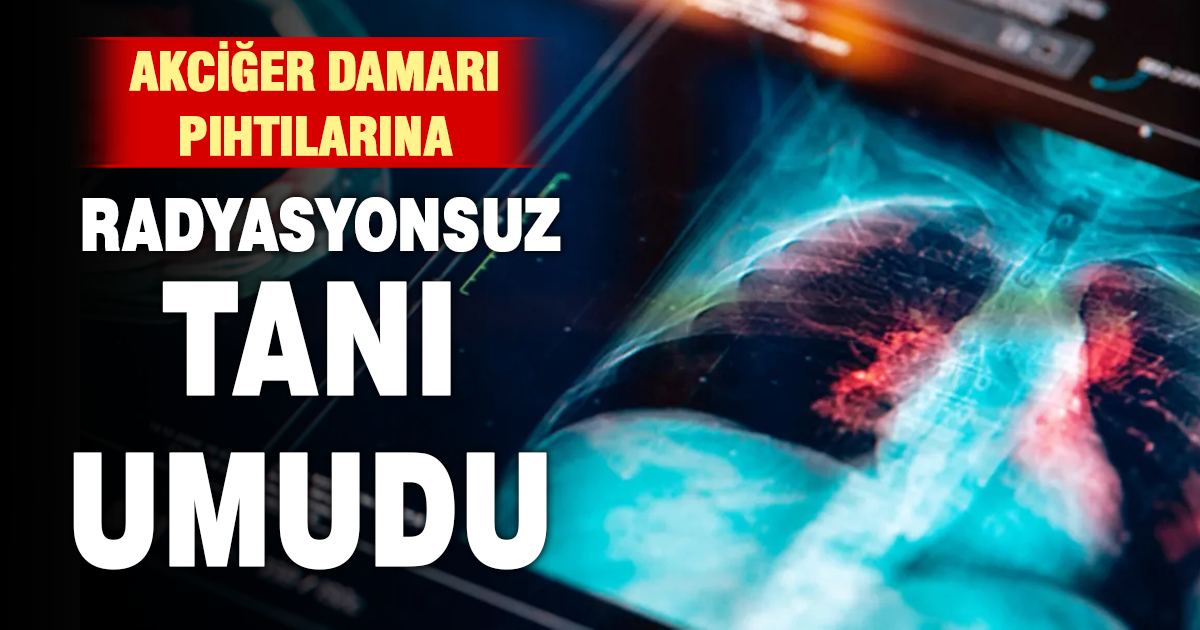 Akciğer damarındaki pıhtıların tanısında radyasyonsuz çözüm
