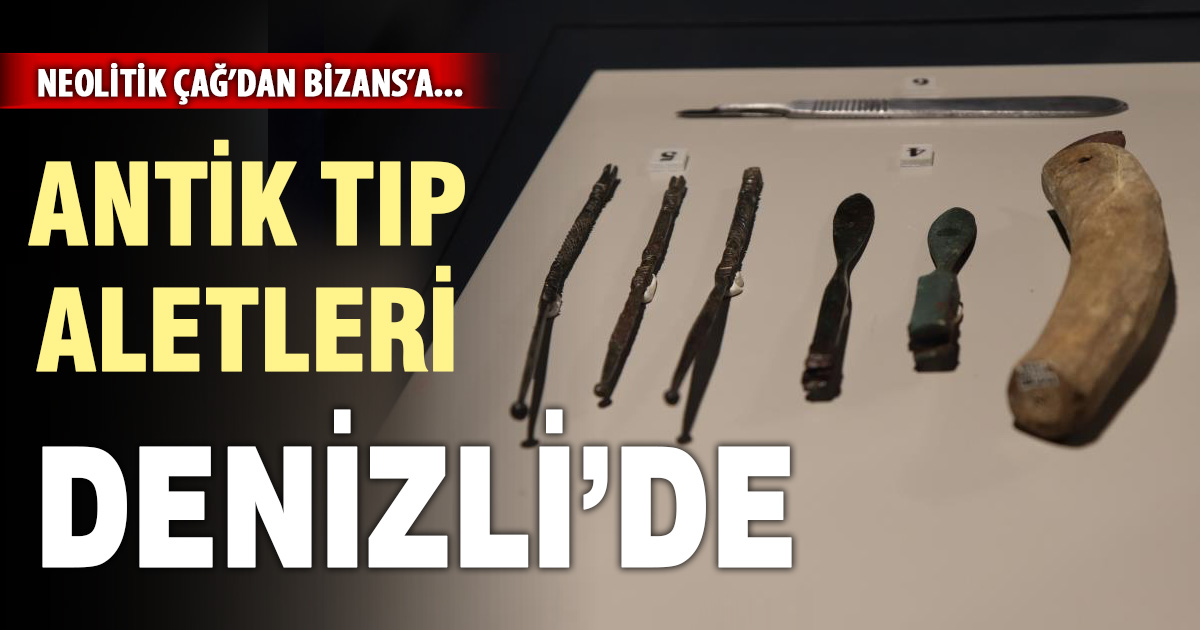 Denizli’de Antik Tıp Aletleri Sergisi yoğun ilgi gördü 