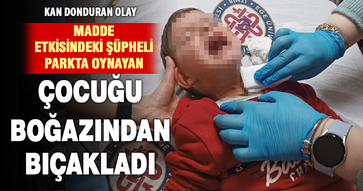 Parkta oynayan 2 yaşındaki çocuğa bıçaklı saldırı 