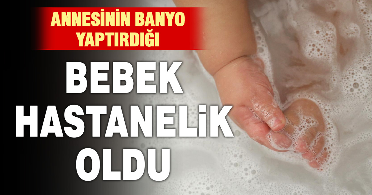 Annesinin banyo yaptırdığı bebek hastanelik oldu