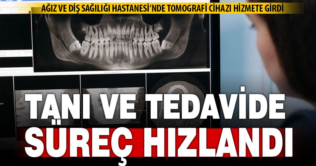Ağız ve Diş Sağlığı hastanesine tomografi cihazı