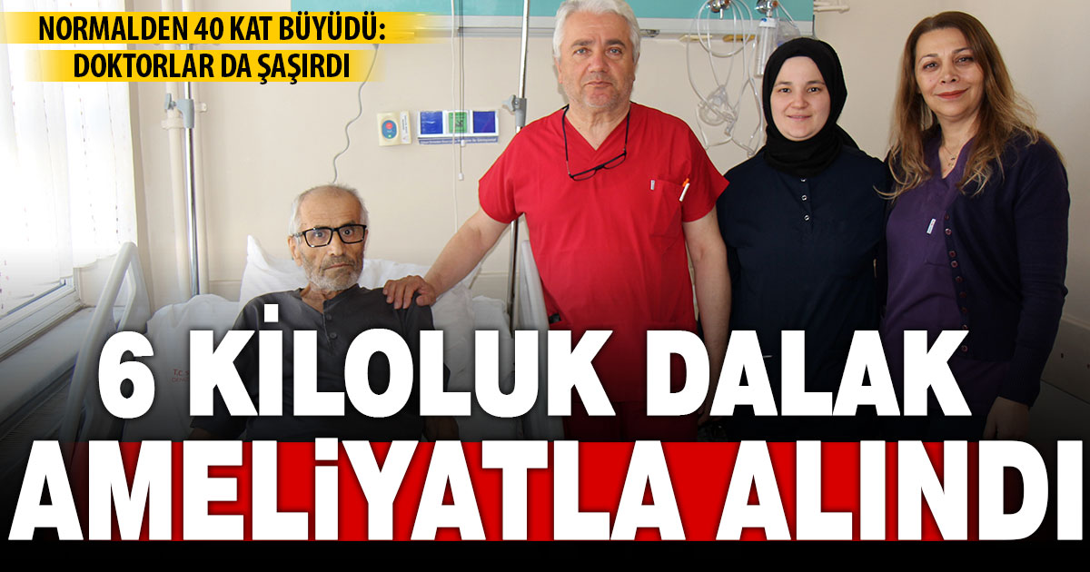 Dalağı normalden 40 kat fazla büyüyen hasta ameliyatla sağlığına kavuştu