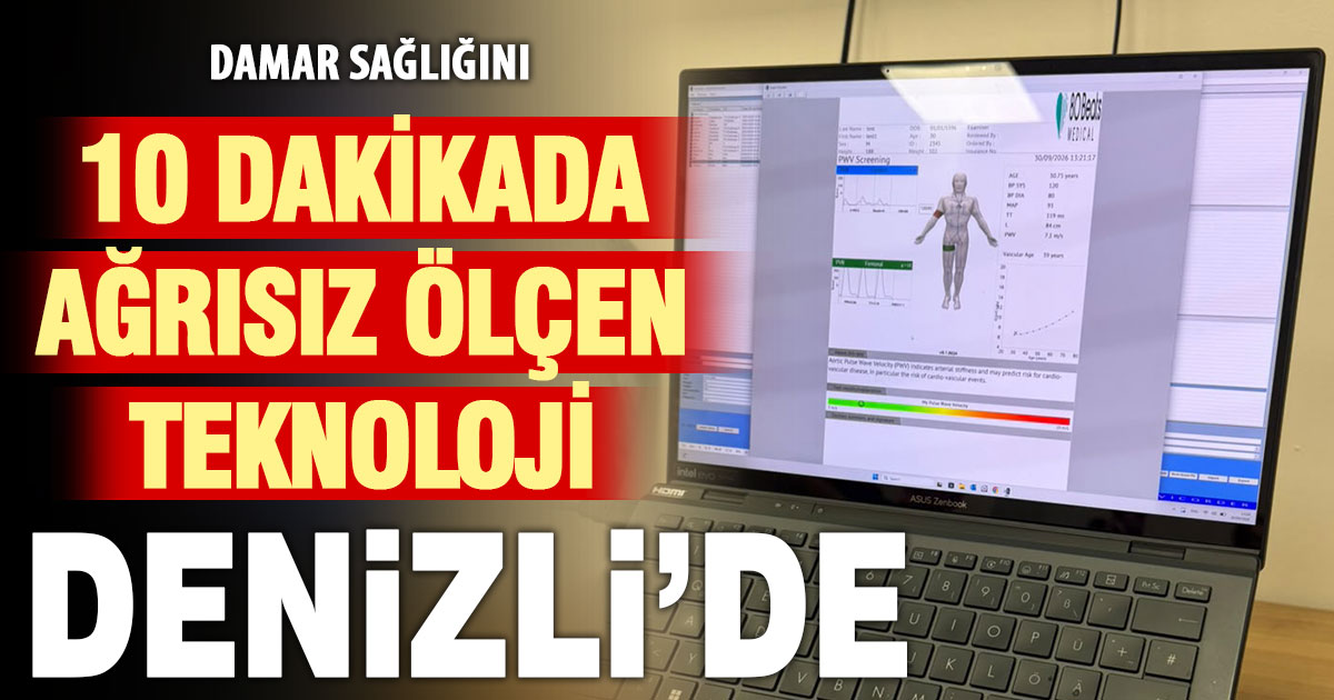 Damar sağlığını ağrısız ölçen yeni teknoloji Denizli’de kullanılmaya başladı